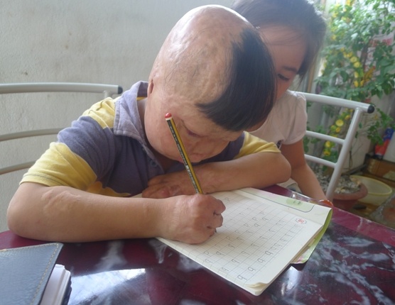 Hiện tại, cháu Linh cũng được mẹ đưa đến trường để đi học, về nhà cậu bé cũng chơi đùa cùng với đám bạn bè trong xóm. Thời gian đã phần nào xóa mờ đi những ký ức đau đớn nơi đứa trẻ này. 