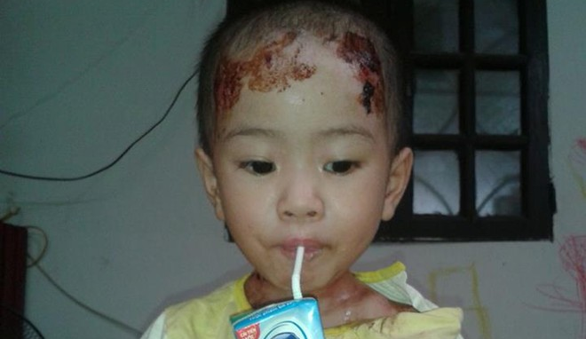 Khong dong y cho be ‘co gioi’ o chua Bo De di chua benh hinh anh