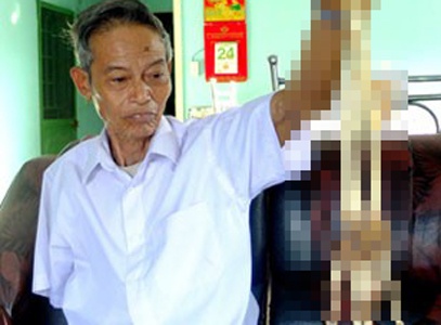 Ky uc nguoi thuong binh tim thay canh tay sau nua the ky hinh anh