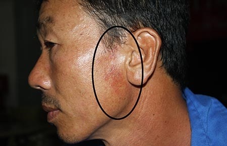 Dan to bi cong an danh vi cai loi vi pham hinh anh