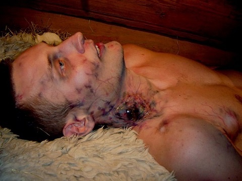 Một người bị nhiễm virus Ebola. 