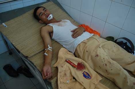 Canh sat giao thong va cuoc chien tren nhung cung duong hinh anh