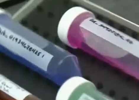 VTC: Da co huyet thanh dieu tri ebola hinh anh