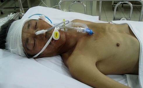 Nguoi dan ong vo danh bi tai nan chan thuong so nao hinh anh