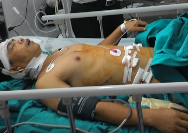 Chuyen lai xe khach gap nan o Lao Cai ve Ha Noi hinh anh