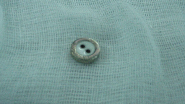 Coi chung di vat o vung kin cua tre hinh anh