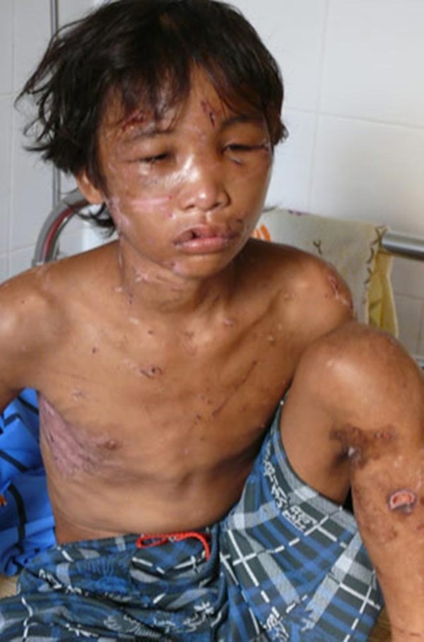 Hào Anh thời điểm vừa được giải cứu. 