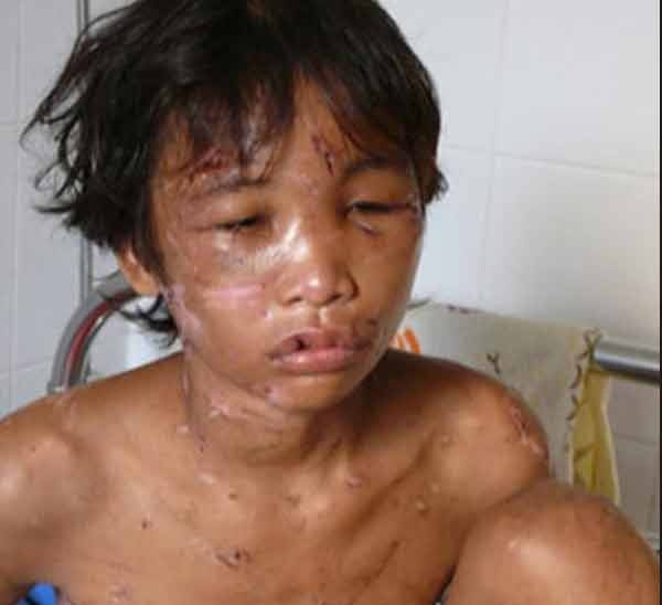 Hao Anh - tu cau be bi hanh ha den loi lam khi yeu hinh anh