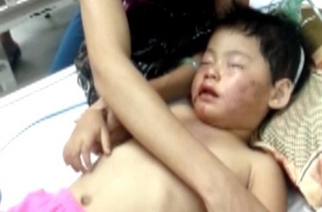 Ke do ruou vao mom be gai: 'Hanh vi cua em qua ac doc' hinh anh