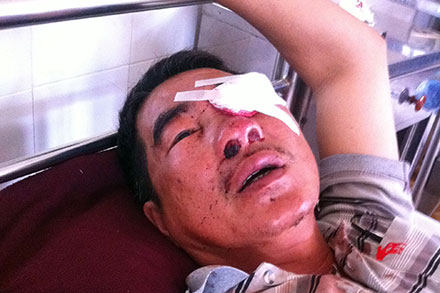 Hanh khach bi nem da: chi co the lap mat gia hinh anh