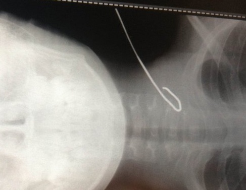 Be trai 11 tuoi bi cong sat dam xuyen co hinh anh