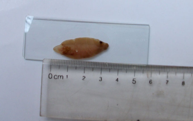 Kích thước sán chui ra từ ngực .