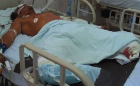 Cut 2 chan vi cua dan hinh anh