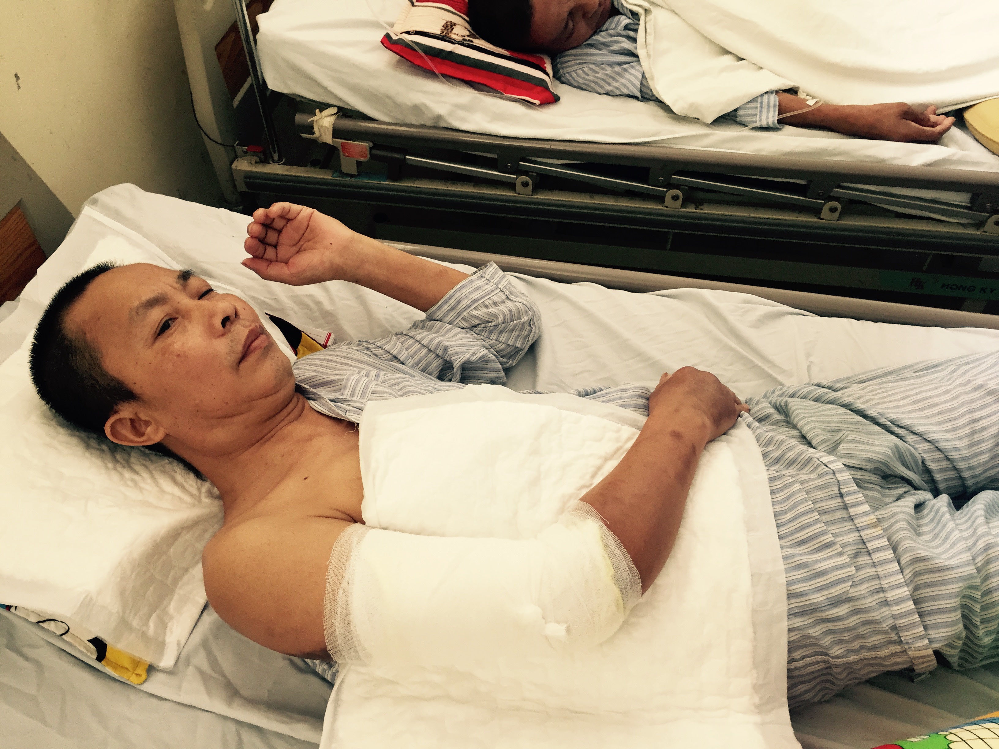 Hoai tu bap tay vi mui tiem giam dau cua benh vien hinh anh