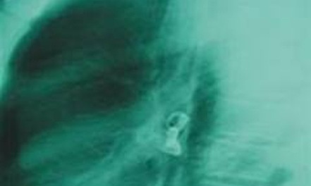 Mot bi can nuot bong den tu sat trong nha tam giam hinh anh