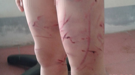 Danh bam dap con trai 7 tuoi vi nghi trom 10.000 dong hinh anh