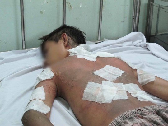 Nam sinh bi ke la tat xang dot gan truong hinh anh