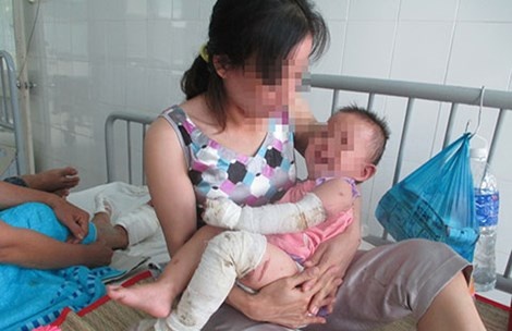 Do xang dot vo, hai minh, hai ca con hinh anh