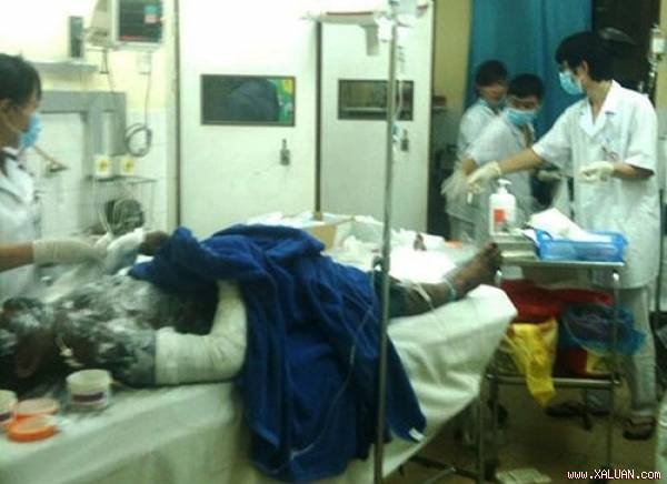 No ham tau khien 3 cong nhan bi bong hinh anh