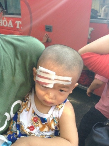 Cháu Nguyễn Phan An Khang bị thương nặng sau vụ ném đá.