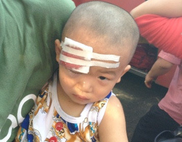 Xe khach bi nem da vo kinh, be 23 thang tuoi trong thuong hinh anh