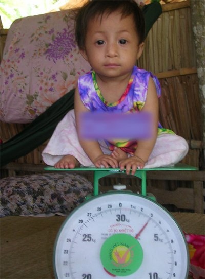 9 năm về trước, Trúc Ly chỉ nặng 3 kg, dù đã 5 tuổi.