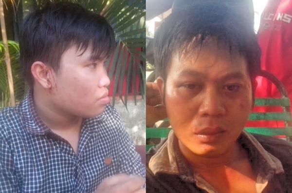 Phong vien Bao Giao thong bi danh, cuop khi tac nghiep hinh anh