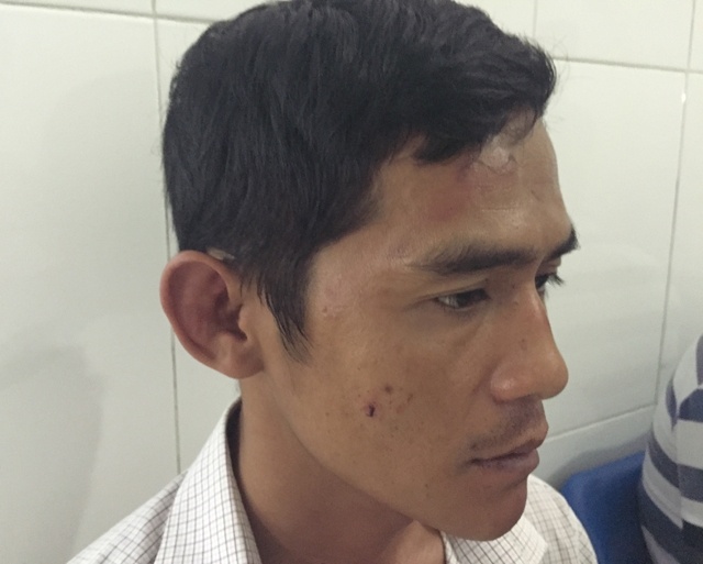 Lái xe Trần Hùng Cường đang được điều trị tại bệnh viện, sau khi bị nhóm côn đồ đánh nhừ tử.