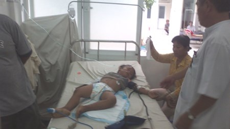 Be 20 thang tuoi bi chan thuong so nao khi di lop hinh anh