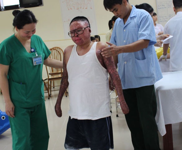 Nghi luc phi thuong cua nguoi linh song sot vu may bay roi hinh anh