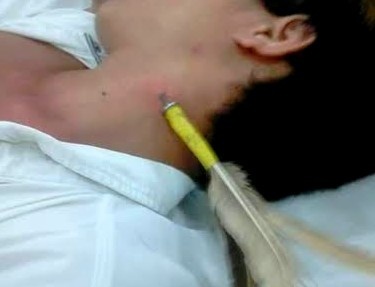 Choi phi tieu, phong nham vao co nhan vien hoi cho hinh anh