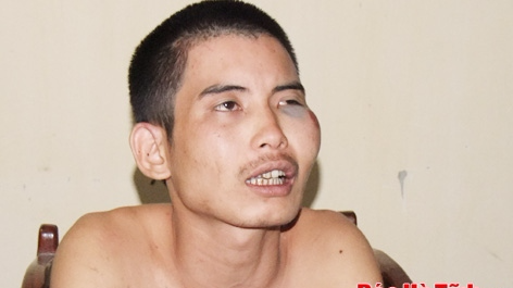 Ngao da, quay pha benh vien roi dam chi mang ban nhau hinh anh
