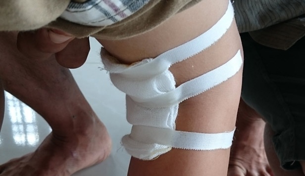 Benh nhan dau chan trai, bac si mo... chan phai hinh anh