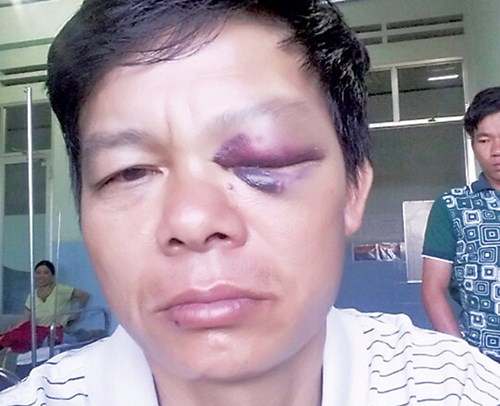 Giat sung, hanh hung, bat kiem lam quy hinh anh