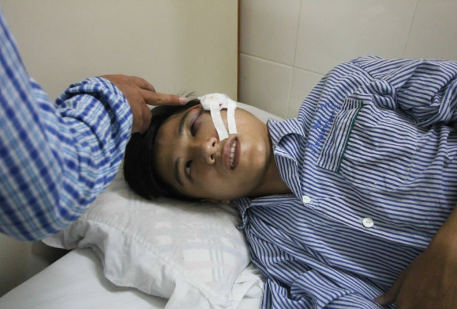 Tuan tra dem, mot canh sat bi nem da trung mat hinh anh