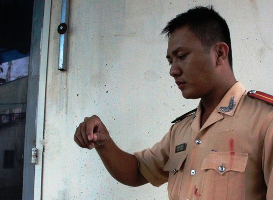 Bi tom, quet 'mau nhiem HIV' chong doi CSGT hinh anh