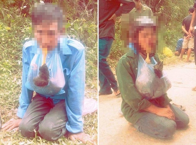 2 nguoi nghien di an trom bi bat ngam ga chet hinh anh
