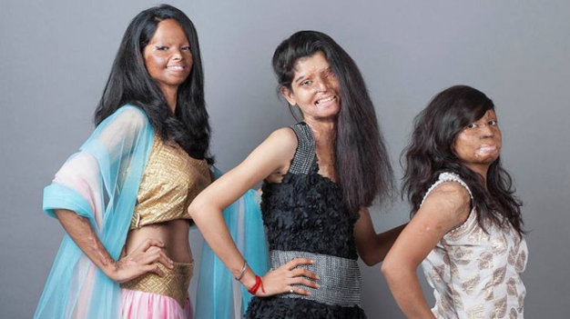 Các cô gái là nạn nhân của những vụ tạt axit trong các bộ trang phục do chính một phụ nữ cũng bị tạt axit thiết kế.