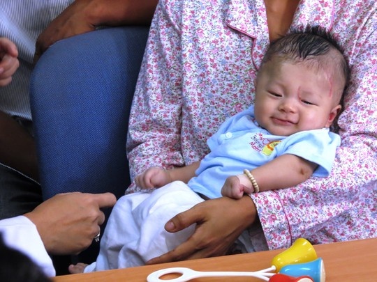 Guong mat thien than cua be bi dam thau so ngay tai kham hinh anh