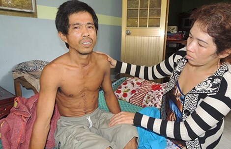 Tu cua co, dam bung vi no nan hinh anh