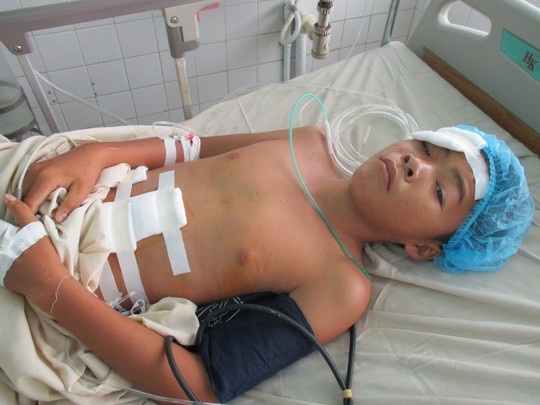 Xe dap bat ngo gay co, nam sinh lop 7 vo gan hinh anh