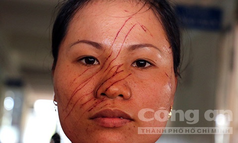 Cong an nhan don de nghi khoi to vu an 2 me con bi rach mat hinh anh