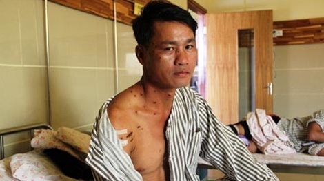 Thu rung noi dien tan cong tho san o 'vuong quoc trau hoang' hinh anh