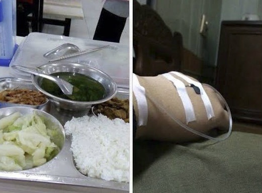 50 cong nhan co bieu hien la sau bua an trua hinh anh