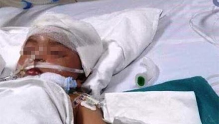 Be gai 3 tuoi bi vot cau long dam xuyen so hinh anh