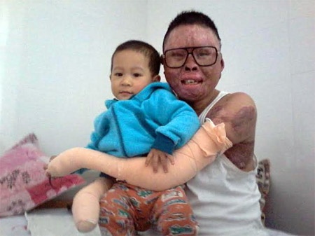 Chien si song sot trong vu roi may bay o Hoa Lac gio ra sao? hinh anh