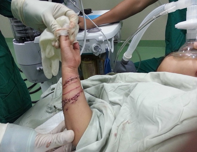 Be 4 tuoi bi ca sau can o Ca Mau hinh anh