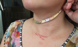 Xong vao nha danh nguoi, cuop day chuyen kim cuong hinh anh