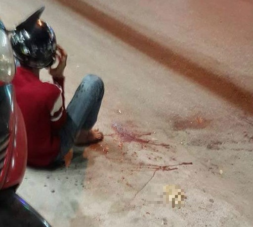 Nan nhan bi giang ho chem dut tay anh 1