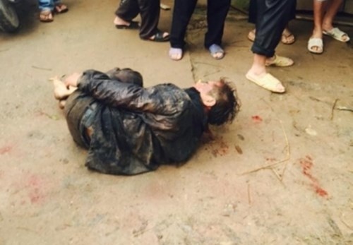 Dung sung ban tra nhieu phat, trom cho bi danh nhu tu hinh anh